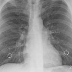  ECOWAS amenaza con medidas y sanciones contra Níger tras insurrección militar